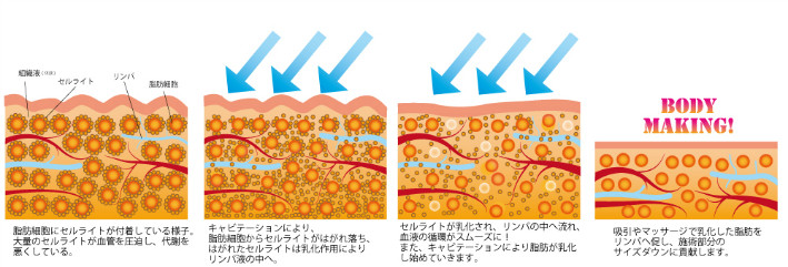 脂肪セルライト乳化イメージ